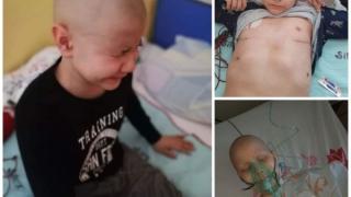 Зов за помощ: Болката, която 10-годишният Ники изпитва, е неистова 