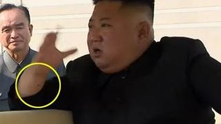 Медици видяха нещо на ръката на Ким Чен Ун и обясниха защо бе изчезнал СНИМКИ