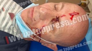Смразяващи кървави СНИМКИ 18+ на боса на „Уолтопия”