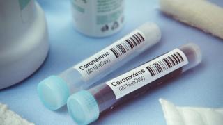 Пациенти със съмнение за К-19 обикалят институциите в Пловдив за безплатен PCR 