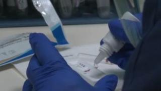 За първи път у нас: Нов тест открива със 100% точност антитела срещу COVID-19