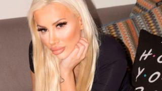 Моделка ослепя, след като ревниво гадже счупи костите по лицето ѝ СНИМКИ 18+