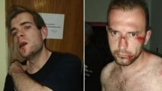 Спецакция на полицията в Секулово, след като тумба от 30 цигани пребиха Боби Ейнджъл