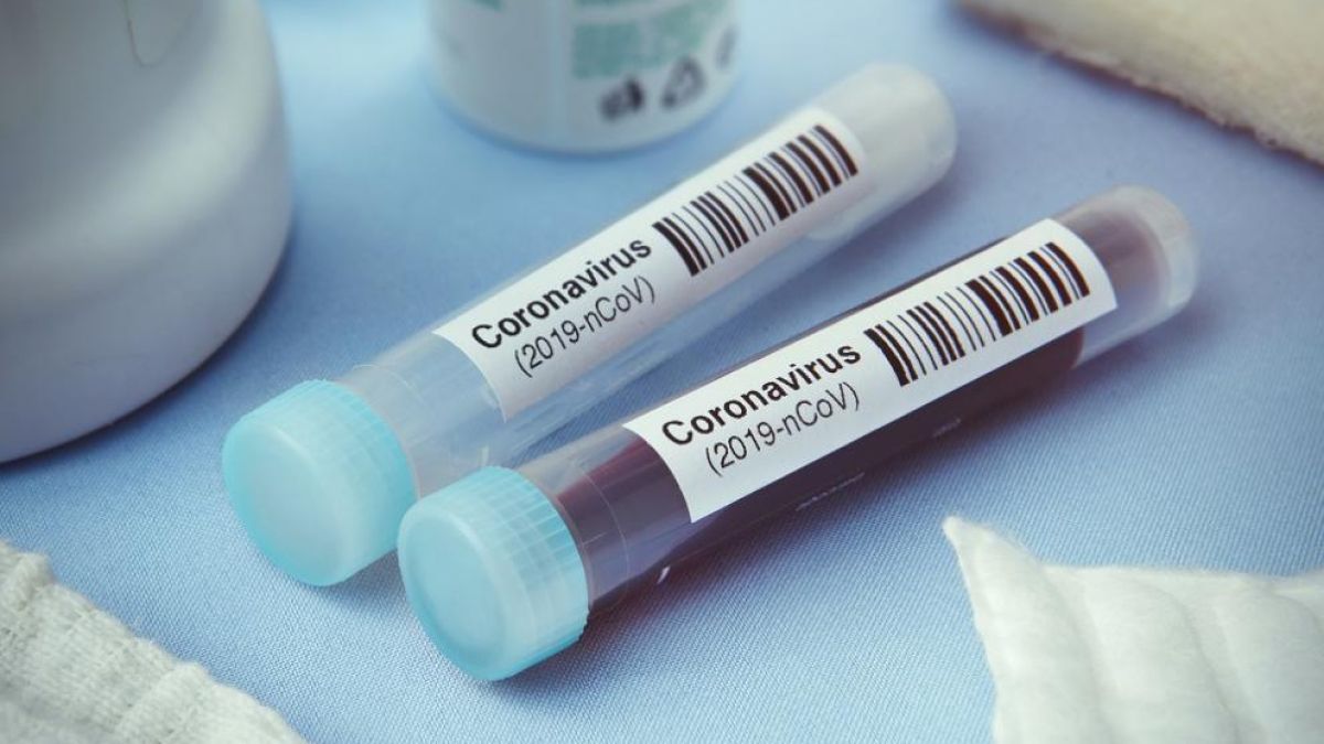 Джихадистка групировка отвори център за лечение на терористи с COVID-19 в Сомалия