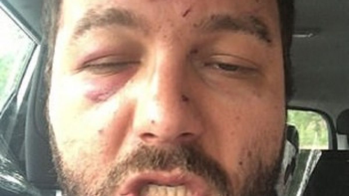 Зверство на Острова: Чернокож и аверът му пребиха български таксиметров шофьор! ВИДЕО 18+