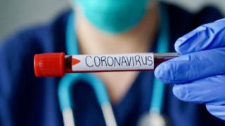 Първо в БЛИЦ!! Още една голяма чалга дива с COVID-19