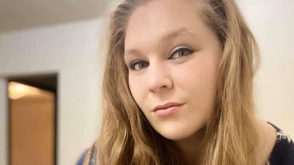 Същински Квазимодо: Красавица си забрави крема и се отрови със слънце СНИМКИ 