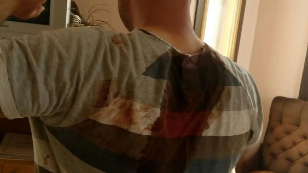 Шокиращи СНИМКИ 18+ на полицаите, ранени от безчинстващите цигани