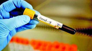 Областният управител на Добрич е с COVID-19