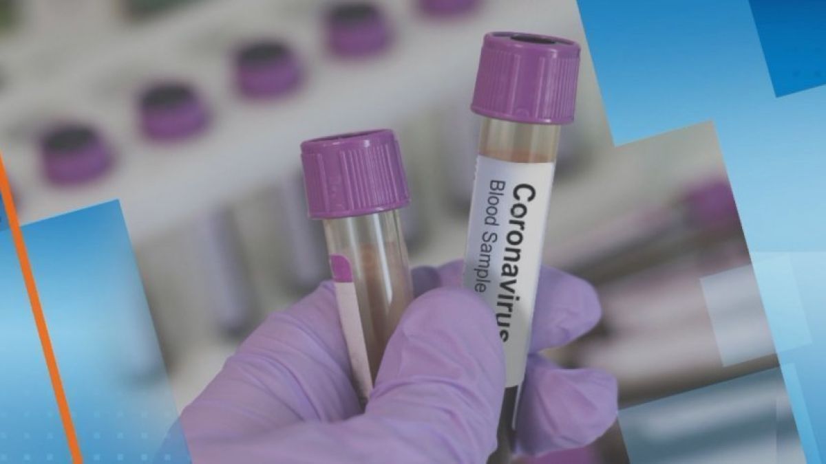 Няма край! Пореден ден с двуцифрен брой починали от COVID-19 у нас