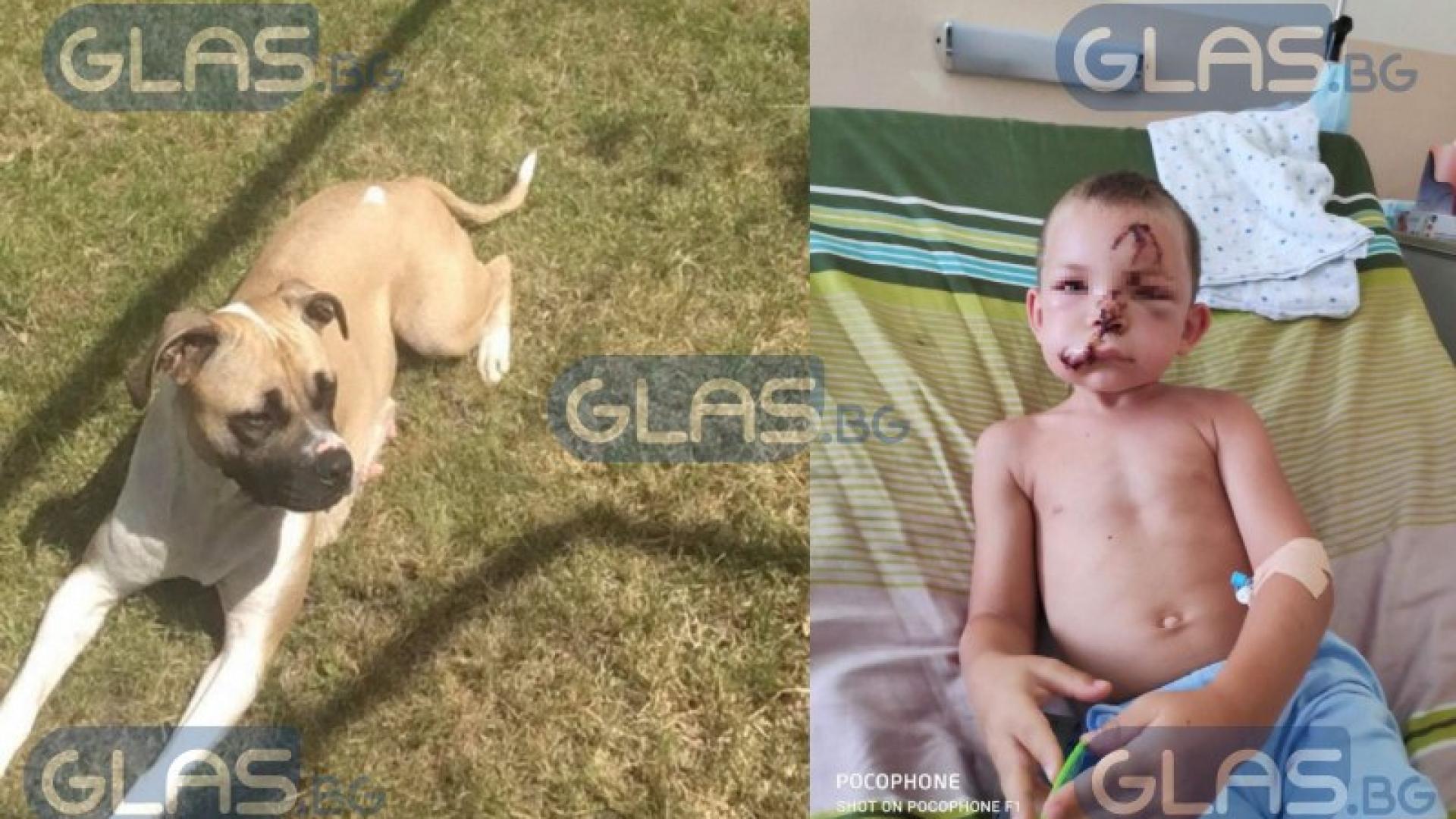 Свирепо куче нагриза жестоко малчуган от Пловдив! Ужасяващи СНИМКИ 18+