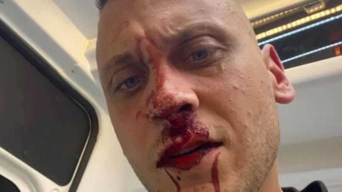 Пребитият лидер на контрапротестите пред БЛИЦ: Знам кой ме поръча! Отровното трио насади агресия срещу мен