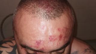 Зловещи подробности за Ради Дългия, пребит брутално от общинар на Марешки ВИДЕО 18+