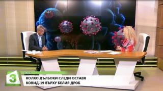 Проф. Костов каза кои хора ще са най-тежко засегнатите от К-19 