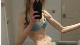 Ани се стопи до фаталните 29 кг, а сега е знойна мадама с пищен бюст ВИДЕО 18+