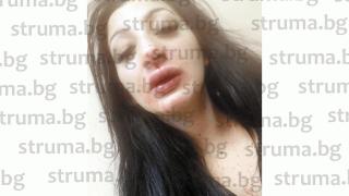 Пребитата от ревнив травестит полицейска щерка с ужасяващи подробности за зверството СНИМКИ 18+