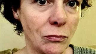 Ужас: 10 месеца британка не може да се отърве от К-19 