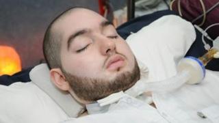 Саудитски принц в кома в продължение на 15 години, изведнъж вдигна ръка ВИДЕО