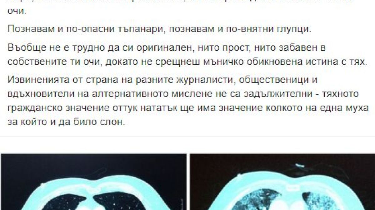 Димчев: Хора от мангъровщината се присмиваха на ген. Мутафчийски, а сега погребват свои близки!