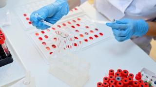 Канадски учени: Хората с тази кръвна група са по-устойчиви на Covid-19