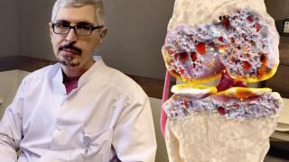  Край на сковаността в ставите