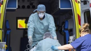 Откриха особеност на организма, която усложнява протичането на COVID-19