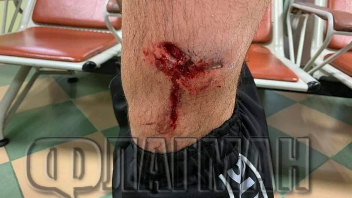 Проговори жертвата на кримигероя Камбаната в Бургас: Помислих, че... СНИМКИ 18+