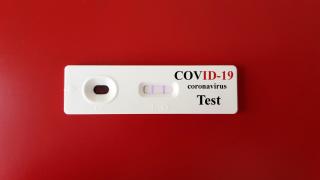 Шок: Българин даде проба за PCR в 2 лаборатории – 2 различни резултата!