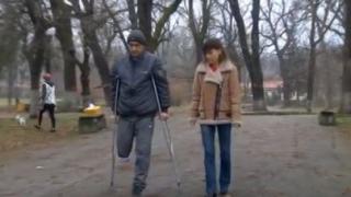 Мъж от Горна Оряховица се зарази с COVID-19 и изгуби крака си ВИДЕО 