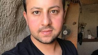 Д-р Убейд Далмъш с важни съвети за всички, които се подлагат на лазерна епилация