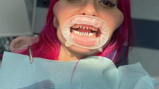 Ужасяваща гледка: Какво направи това момиче с лицето си?! СНИМКИ 