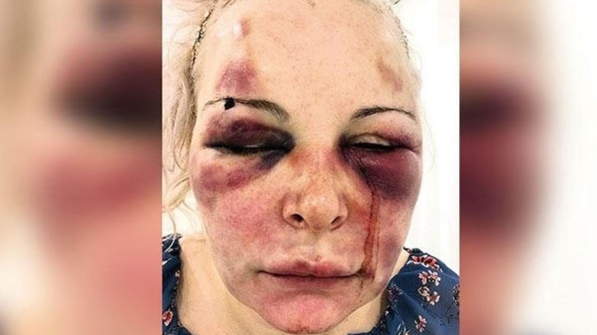 Ще ти нарежа лицето: Жесток любовник два дни изтезава новата си приятелка СНИМКИ  