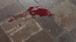 Ужасна гледка в Бургас: Мъж с окървавена глава седи пред Водната палата СНИМКИ