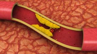 Редовната консумация на този продукт понижава холестерола
