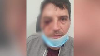 Маскирани пребиха с чукове мъж в центъра на София посред бял ден ВИДЕО