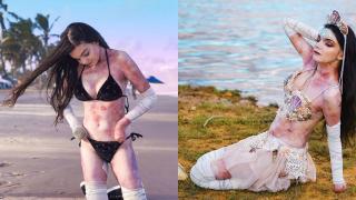 Тялото на моделка е обезобразено, но всички са влюбени в нея СНИМКИ 18+