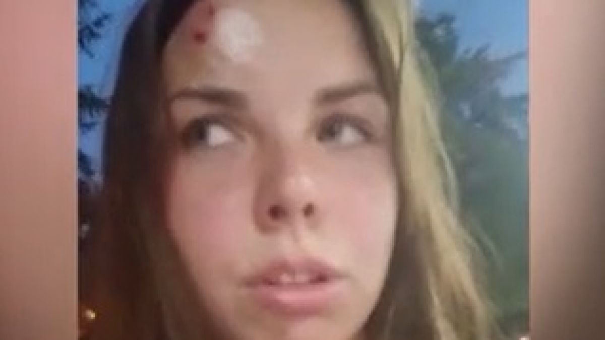 6-годишен простреля майка си в челото ВИДЕО
