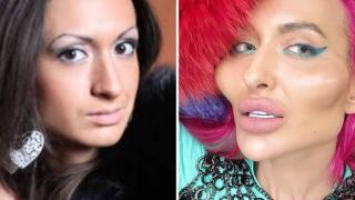 32-годишната Анастасия се обезобрази! Плашещи СНИМКИ 18+