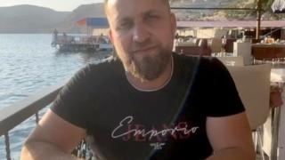 28-г. бръснар умря мистериозно по време на операция по трансплантация на коса 