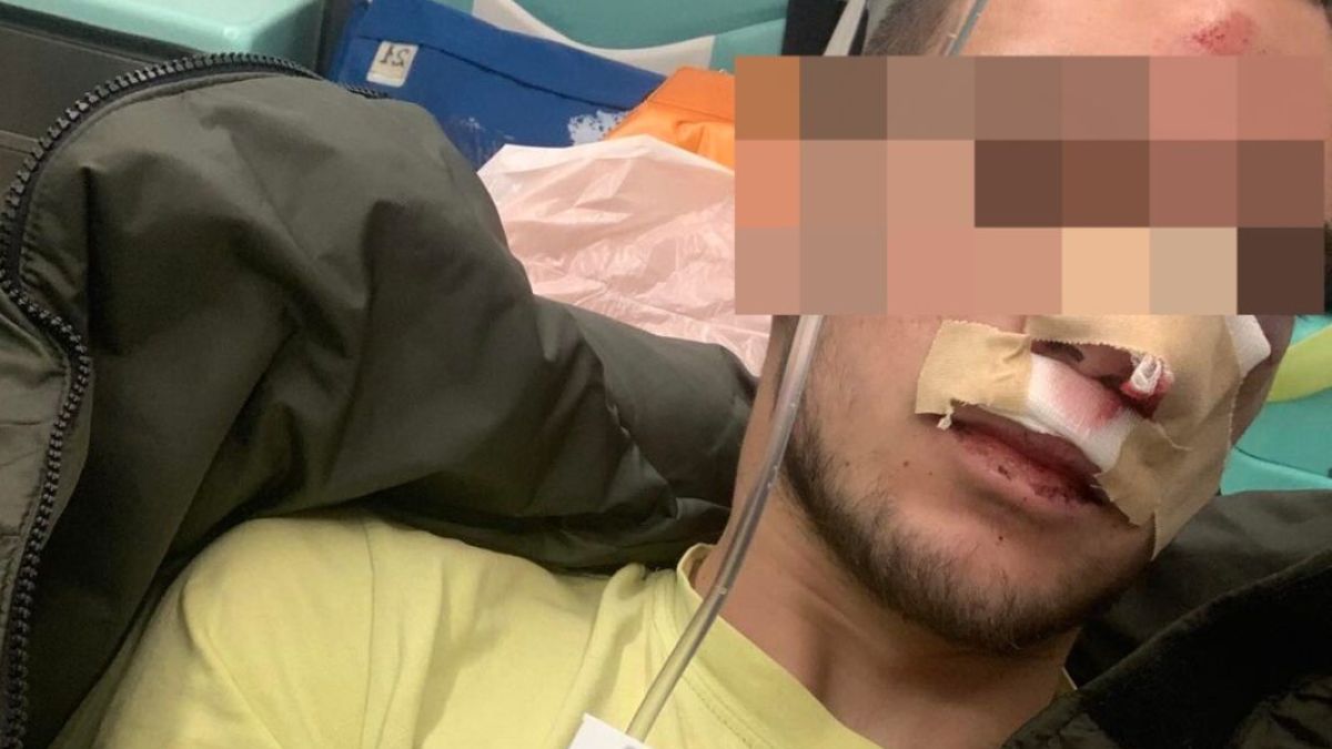 19-г. стана жертва на брутален побой пред дома си в Казанлък ВИДЕО 18+