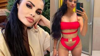 Красива козметичка се оказа злодейка и обезобрази пациентки СНИМКИ 18+ 