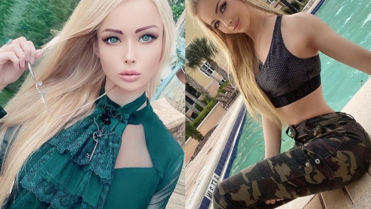 Жив скелет: "Украинската Барби" е неузнаваема заради К-19 СНИМКИ