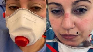 Не е за слабонервни! Момиче от Банско работи в К-19 отделение в Англия и разказва как умират мъчително тук предимно неваксинирани!