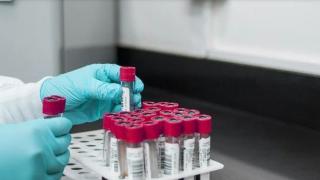 Пловдивчанин си пусна тест за антитела и му призля от видяното