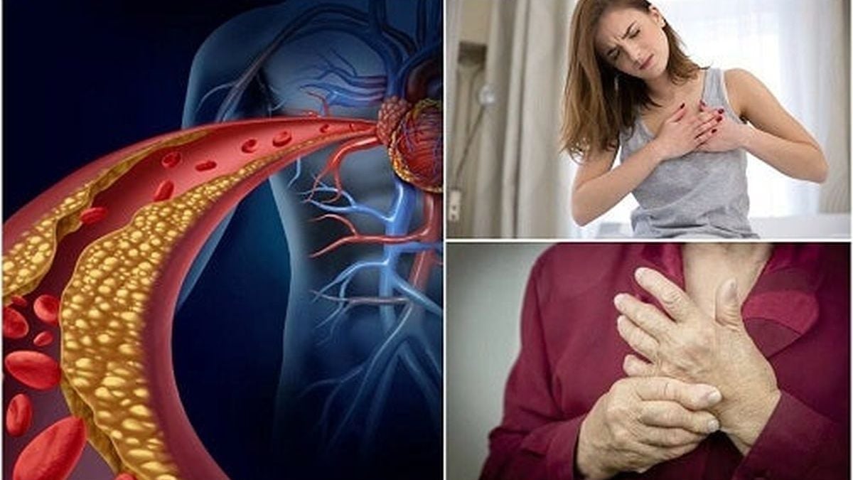 Учени посочиха необичаен симптом, алармиращ опасни нива на холестерола