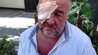 Разбра се кой преби и ослепи оперния певец в София ВИДЕО