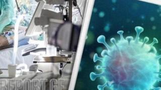 Учени показаха как изглежда мутантът Омикрон СНИМКА