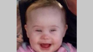 Зловещо: Баща и мащеха зарязаха дете инвалид да бъде изядено от плъховете