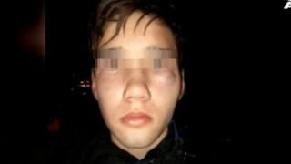 Ето какво се случи с ученика, бит и унижаван в жк "Лагера"