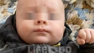 Бебе на 2 месеца е в медикаментозна кома след инсулт, причинен от Омикрон